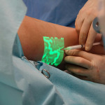 Augmented Reality Vein Finder