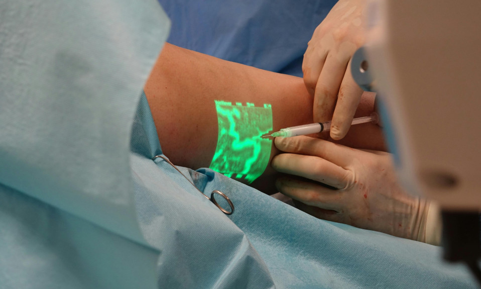 Augmented Reality Vein Finder